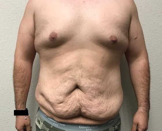 Before Image