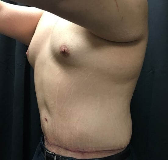 Left side view After