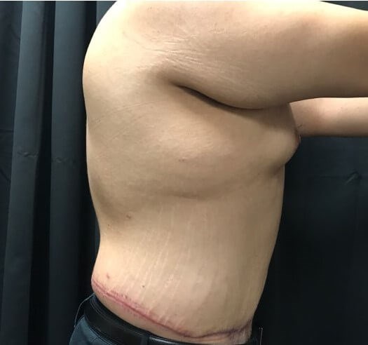 Right side view After